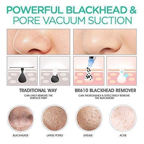 VOYOR Blackhead Remover Vacuum Suction Facial Pore Cleaner Electric Acne Comedone Extractor Kit with 4 Replacement Head & LCD Screen for Women and Men Black Heads Extraction BR610 - NORTH FIRST PLUS, LLC