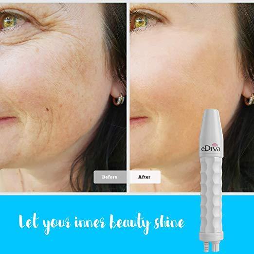 Portable High Frequency Skin Tightening Acne Spot Wrinkles Remover by eDiva Beauty Therapy Puffy Eyes Body Care Facial Machine - NORTH FIRST PLUS, LLC