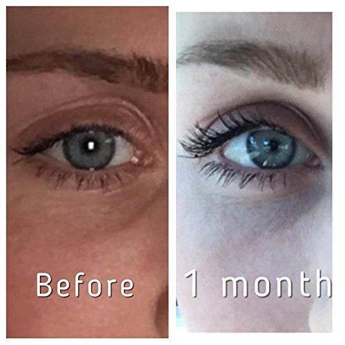 Pronexa Eyelash Growth Enhancer Brow Serum - NORTH FIRST PLUS, LLC